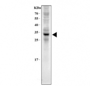 Western blot testing of human PC-3 cell lysate with SOD3 antibody. Predicted molecular weight: 26-32 kDa.