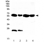 Western blot testing of 1) rat liver, 2) rat kidney, 3) mouse liver and 4) mouse kidney lysate with UGT1A1 antibody at 0.5ug/ml. Predicted molecular weight ~59 kDa.
