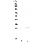 Western blot testing of human 1) MCF7 and 2) COLO320 antibody at 0.5ug/ml. Predicted molecular weight ~27 kDa.