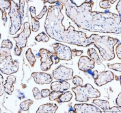IHC testing of FFPE human placental tissue with ITGA5 antibody. Required HIER: steam section in pH8 EDTA buffer for 20 min and allow to cool prior to testing.