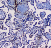 IHC testing of FFPE human placental tissue with ITGA5 antibody. Required HIER: steam section in pH6 citrate buffer for 20 min and allow to cool prior to testing.