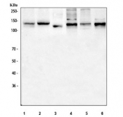 Western blot testing of 1) human A549, 2) human HeLa, 3) human placenta, 4) rat brain, 5) rat PC-12 and 6) mouse brain tissue lysate with ITGA5 antibody. Expected molecular weight: 115-160 kDa depending on glycosylation level.
