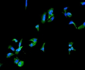 Immunofluorescent staining of FFPE human HeLa cells with ITGA5 antibody (green) and DAPI nuclear stain (blue). HIER: boil tissue sections in pH6, 10mM citrate buffer, for 10-20 min and allow to cool before testing.