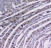 IHC testing of FFPE rat heart tissue with ITGA5 antibody at 1ug/ml. Required HIER: steam section in pH6 citrate buffer for 20 min and allow to cool prior to testing.