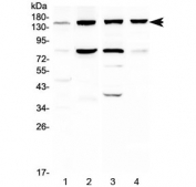 Western blot testing of 1) human HeLa, 2) human HepG2, 3) rat liver and 4) mouse liver lysate with ITGA5 antibody at 0.5ug/ml. Expected molecular weight: 115-160 kDa depending on glycosylation level.
