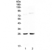 Western blot testing of 1) rat kidney and 2) mouse kidney lysate with NMU antibody at 0.5ug/ml. Expected molecular weight: 20-25 kDa.
