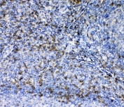 IHC testing of FFPE human tonsil tissue with CD7 antibody at 1ug/ml. Required HIER: steam section in pH6 citrate buffer for 20 min and allow to cool prior to testing.