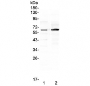 Western blot testing of human 1) placenta and 2) MCF7 lysate with FZD4 antibody at 0.5ug/ml. Predicted molecular weight ~60 kDa.