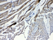 IHC testing of FFPE mouse heart tissue with FZD4 antibody at 1ug/ml. Required HIER: steam section in pH6 citrate buffer for 20 min and allow to cool prior to testing.