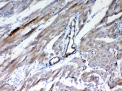 IHC testing of FFPE rat heart tissue with FZD4 antibody at 1ug/ml. Required HIER: steam section in pH6 citrate buffer for 20 min and allow to cool prior to testing.