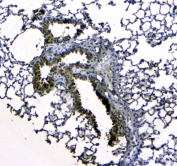 IHC testing of FFPE mouse lung tissue with Scgb1a1 antibody at 1ug/ml. Required HIER: steam section in pH6 citrate buffer for 20 min and allow to cool prior to testing.