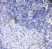 IHC testing of FFPE mouse spleen tissue with Cd8a antibody at 1ug/ml. Required HIER: steam section in pH6 citrate buffer for 20 min and allow to cool prior to testing.
