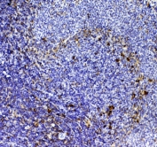 IHC testing of FFPE rat spleen tissue with Cd8a antibody at 1ug/ml. Required HIER: steam section in pH6 citrate buffer for 20 min and allow to cool prior to testing.