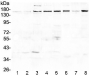 Western blot testing of rat 1) spleen, 2) thymus, 3) brain, 4) lung and mouse 5) spleen, 6) brain, 7) HEPA1-6 and 8) NIH3T3 lysate with EEA1 antibody at 0.5ug/ml. Predicted molecular weight ~162 kDa.