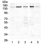 Western blot testing of human 1) HeLa, 2) placenta, 3) COLO320, 4) 22RV1 and 5) A549 lysate with EEA1 antibody at 0.5ug/ml. Predicted molecular weight ~162 kDa.