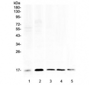 Western blot testing of 1) human placenta, 2) human HeLa, 3) rat spleen, 4) rat RH35 and 5) mouse spleen lysate with Psoriasin antibody at 0.5ug/ml. Predicted molecular weight: 11-13 kDa, observed here at ~17 kDa.
