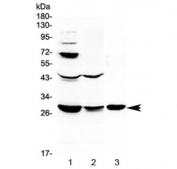 Western blot testing of 1) rat liver, 2) rat kidney and 3) mouse kidney lysate with TL1A antibody at 0.5ug/ml. Predicted molecular weight ~28 kDa.