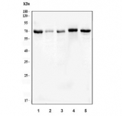 Western blot testing of 1) human SiHa, 2) human A431, 3) human HCCT, 4) human HeLa and 5) rat PC-12 cell lysate with FCGR1A antibody. Predicted molecular weight: 39-75 kDa depending on glycosylation level.