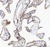 IHC staining of FFPE human placental tissue with CDH5 antibody. HIER: boil tissue sections in pH8 EDTA for 20 min and allow to cool before testing.