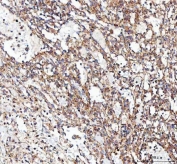 IHC staining of FFPE human spleen tissue with CDH5 antibody. HIER: boil tissue sections in pH8 EDTA for 20 min and allow to cool before testing.