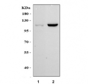 Western blot testing of human 1) HeLa and 2) 293T cell lysate with CDH5 antibody. Expected molecular weight: 90~140 kDa depending on glycosylation level.
