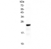 Western blot testing of rat thymus lysate with Cd3e antibody at 0.5ug/ml. Predicted molecular weight. Expected molecular weight ~23 kDa.