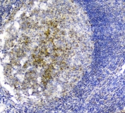 IHC staining of FFPE human tonsil tissue with PLK2 antibody. HIER: boil tissue sections in pH8 EDTA for 20 min and allow to cool before testing.