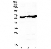 Western blot testing of human 1) SW579, 2) SKOV3 and 3) U-87 MG cell lysate with Glycerol kinase antibody at 0.5ug/ml. Predicted molecular weight ~61 kDa.