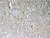 IHC testing of FFPE mouse liver tissue with GALNS antibody at 1ug/ml. Required HIER: steam section in pH6 citrate buffer for 20 min and allow to cool prior to testing.