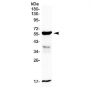 Western blot testing of rat small intestine lysate with GALNS antibody at 0.5ug/ml. Predicted molecular weight ~58 kDa.