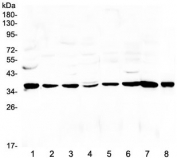 Western blot testing of rat 1) liver, 2) spleen, 3) brain, 4) kidney, 5) thymus, 6) PC-12, 7) RH35 and 8) mouse SP20 lysate with THPO antibody at 0.5ug/ml. Predicted molecular weight: 38 kDa, routinely observed at 40-55 kDa (unmodified), 80-95 kDa (glycosylated).