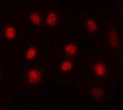 Immunofluorescent staining of FFPE human A549 cells with MAX antibody (red). HIER: steam section in pH6 citrate buffer for 20 min.