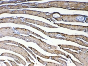 IHC testing of FFPE mouse heart tissue with CXCL14 antibody at 1ug/ml. Required HIER: steam section in pH6 citrate buffer for 20 min and allow to cool prior to testing.