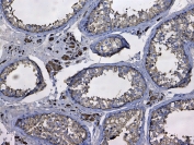 IHC testing of FFPE human testis tissue with GSTM3 antibody at 1ug/ml. Required HIER: steam section in pH6 citrate buffer for 20 min and allow to cool prior to testing.