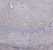 IHC testing of FFPE mouse brain tissue with GSTM3 antibody at 1ug/ml. Required HIER: steam section in pH6 citrate buffer for 20 min and allow to cool prior to testing.