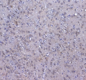 IHC testing of FFPE rat brain tissue with GSTM3 antibody at 1ug/ml. Required HIER: steam section in pH6 citrate buffer for 20 min and allow to cool prior to testing.