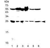 Western blot testing of 1) rat testis, 2) rat brain, 3) mouse testis, 4) mouse brain, 5) human HeLa and 6) human MCF7 lysate with GSTM3 antibody at 0.5ug/ml. Predicted molecular weight ~26 kDa.