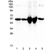 Western blot testing of 1) rat liver, 2) rat liver (different lot), 3) mouse liver, 4) mouse liver (different lot) and 5) human placenta lysate with Vitamin D binding protein antibody at 0.5ug/ml. Predicted molecular weight ~53 kDa.