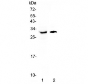 Western blot testing of 1) rat liver and 2) mouse liver lysate with AQP9 antibody at 0.5ug/ml. Predicted molecular weight ~32 kDa.