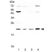Western blot testing of human 1) MCF7, 2) COLO320, 3) SK-OV-3 and 4) HepG2 cell lysate with KLK2 antibody at 0.5ug/ml. Predicted molecular weight ~17-29 kDa (multiple isoforms).