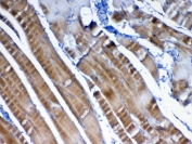 IHC testing of FFPE rat skeletal muscle tissue with VEGFB antibody at 1ug/ml. Required HIER: steam section in pH6 citrate buffer for 20 min and allow to cool prior to testing.