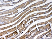 IHC testing of FFPE mouse heart tissue with VEGFB antibody at 1ug/ml. Required HIER: steam section in pH6 citrate buffer for 20 min and allow to cool prior to testing.