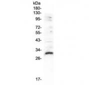 Western blot testing of rat heart lysate with VEGFB antibody at 0.5ug/ml. Expected molecular weight: 22-32 kDa depending on glycosylation level.