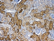 IHC testing of FFPE mouse kidney tissue with FZD3 antibody at 1ug/ml. Required HIER: steam section in pH6 citrate buffer for 20 min and allow to cool prior to testing.
