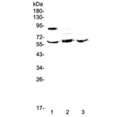 Western blot testing of human 1) placenta, 2) HepG2 and 3) MCF7 lysate with HSF2 antibody at 0.5ug/ml. Predicted molecular weight ~60 kDa.
