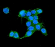 Immunofluorescent staining of FFPE human MCF7 cells with IQGAP2 antibody (green) and DAPI nuclear stain (blue). HIER: steam section in pH6 citrate buffer for 20 min.