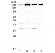 Western blot testing of human 1) HeLa, 2) placenta, 3) HepG2 and 4) mouse stomach lysate with IQGAP2 antibody at 0.5ug/ml. Predicted molecular weight ~181 kDa.