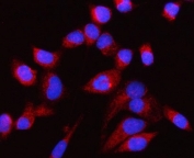 Immunofluorescent staining of FFPE human HeLa cells with CP110 antibody (red) and DAPI nuclear stain (blue). HIER: steam section in pH6 citrate buffer for 20 min.