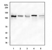 Western blot testing of 1) human MOLT4, 2) human HeLa, 3) human PANC-1, 4) rat PC-12 and 5) mouse RAW264.7 cell lysate with CP110 antibody. Expected molecular weight ~110 kDa.