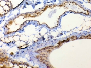 IHC testing of FFPE mouse lung tissue with TSPAN12 antibody at 1ug/ml. Required HIER: steam section in pH6 citrate buffer for 20 min and allow to cool prior to testing.